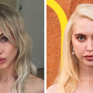 Alix Lynx Fires Back at 'Euphoria' Star on OnlyFans Empowerment Debate
