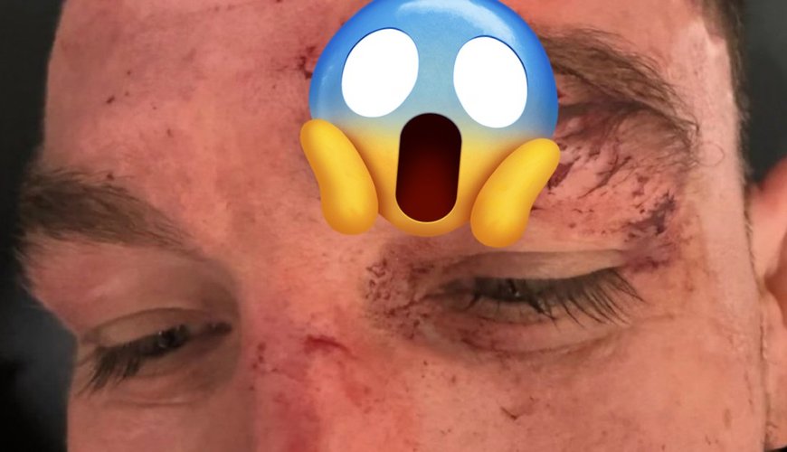 Austin Vanderford's UFC 320 Bout Leaves Fans in Shock