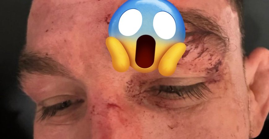 Austin Vanderford's UFC 320 Bout Leaves Fans in Shock