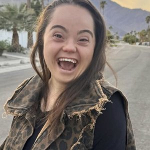 Controversial AI Trend Exploiting Down Syndrome for Adult Content Sparks Outrage