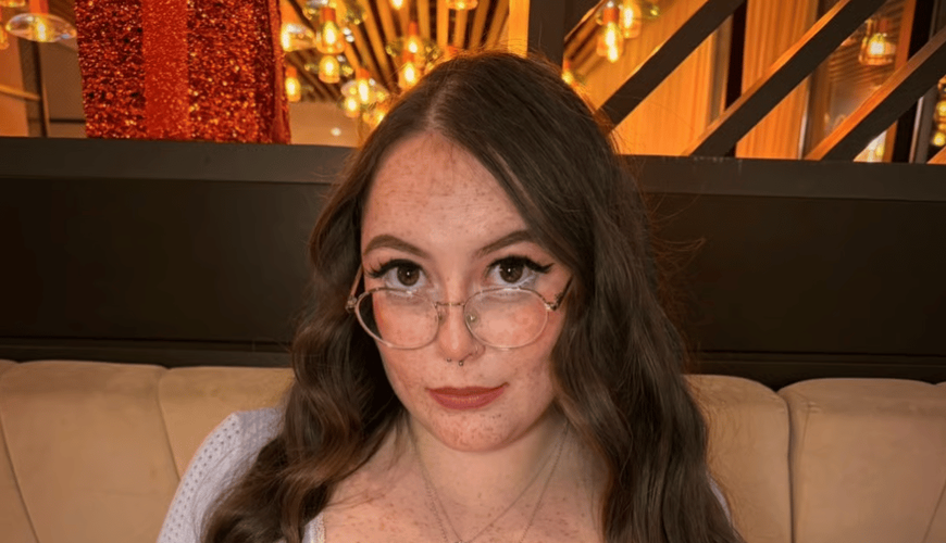 From Struggle to Stardom: Summer Robert Turns a Rare Condition into a Confidence Boost