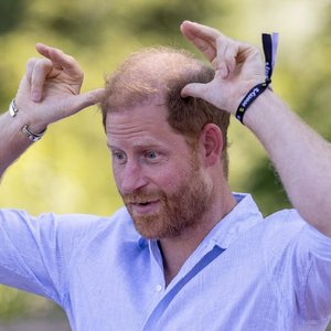 Prince Harry Gets Up Close with Baby Goats and a Surprise Injury