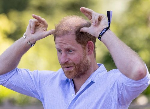 Prince Harry Gets Up Close with Baby Goats and a Surprise Injury