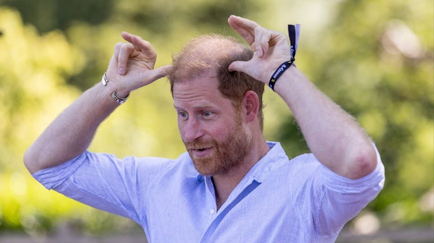 Prince Harry Gets Up Close with Baby Goats and a Surprise Injury